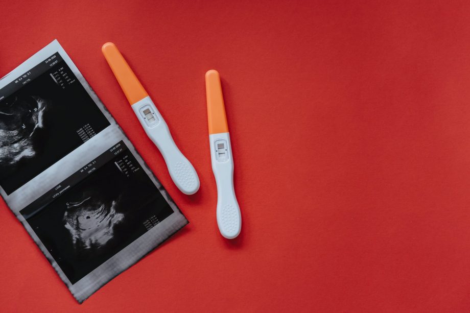 Ilustrasi hasil tes kesuburan rahim dengan menggunakan usg dan ovulasi strip